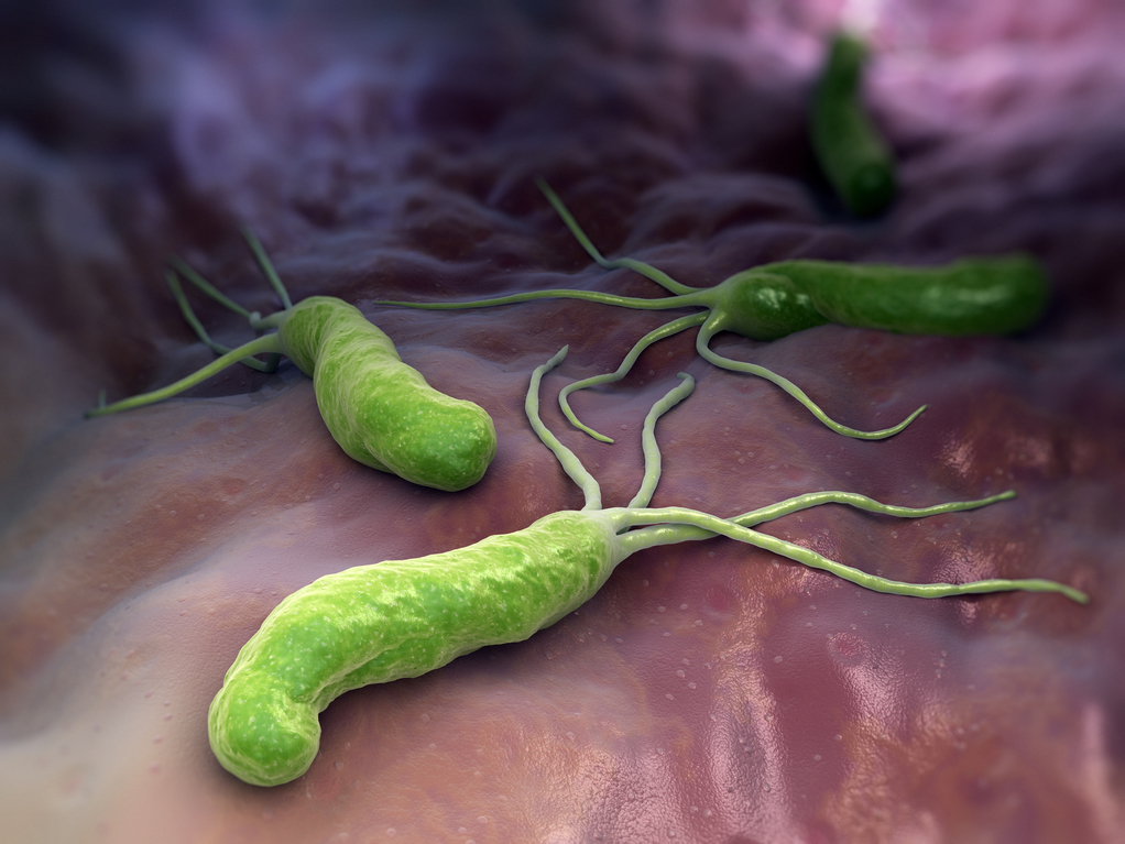 This bacteria is a time bomb in your stomach